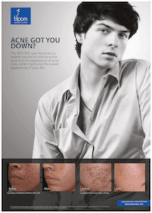A man with acne is shown in this advertisement.