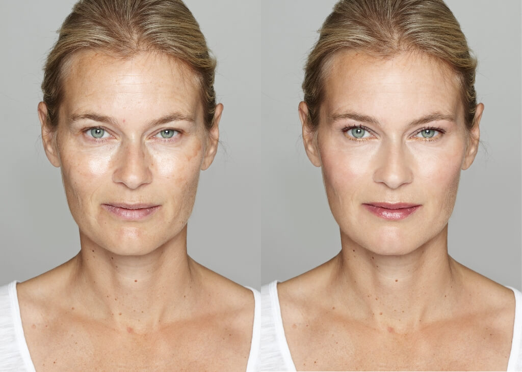 before and after photos of a makeover treatment